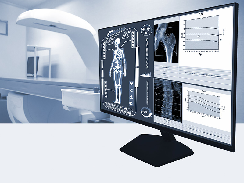 Imagen del curso Básico de densitometría